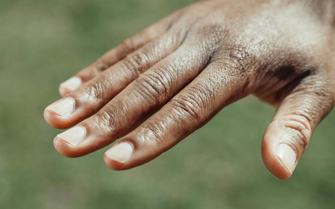 Middle Finger Knuckle Pain: Causes & Treatment