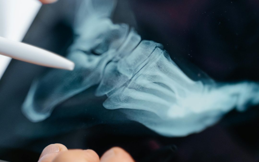 Can You See Arthritis in an X-Ray?