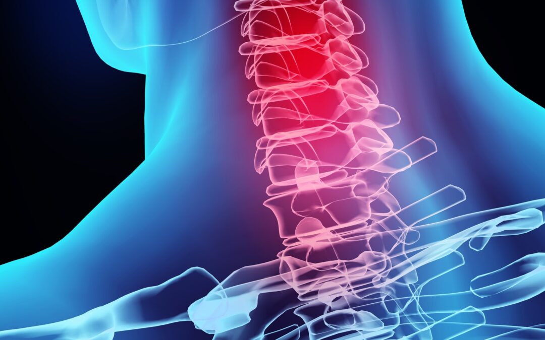 What exactly is whiplash